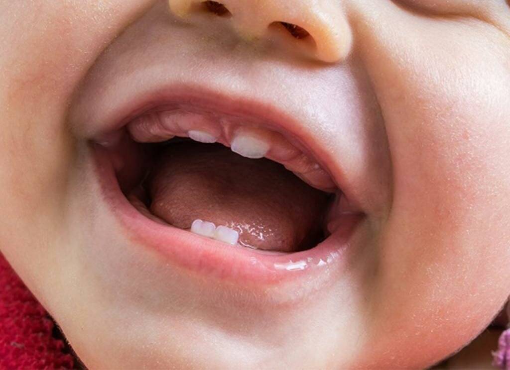 Первые зубы у грудничка: когда прорезываются и как снять боль