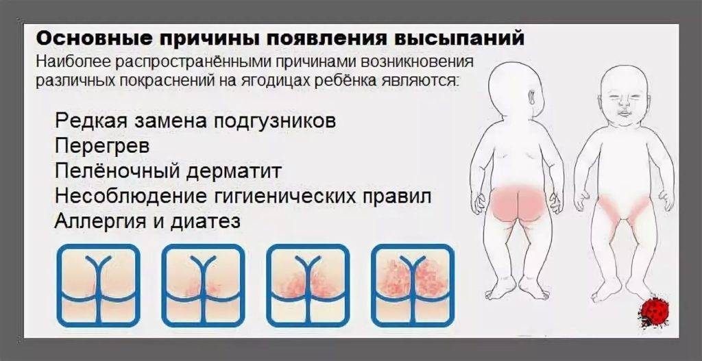 Атрезия ануса и прямой кишки у детей — лечение, диагностика, симптомы и причины болезни | николаев в.в.
