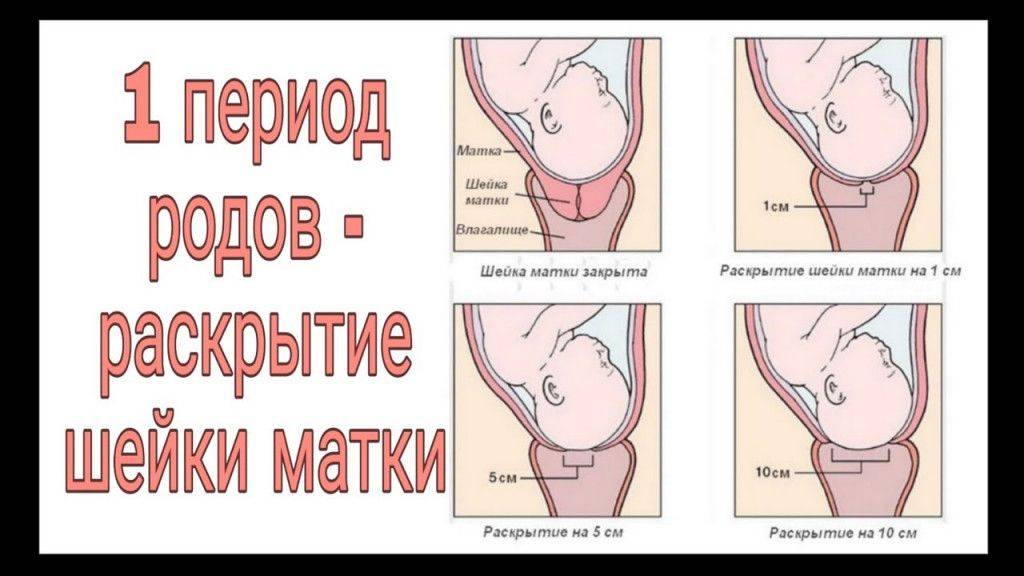 Как подготовить шейку матки к родам: советы и рекомендации