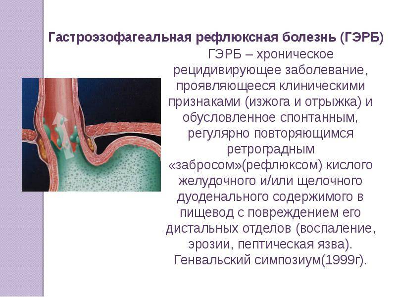 Гастроэзофагеальнорефлюксная (гэрб) болезнь у детей и подростков - доказательная медицина для всех
