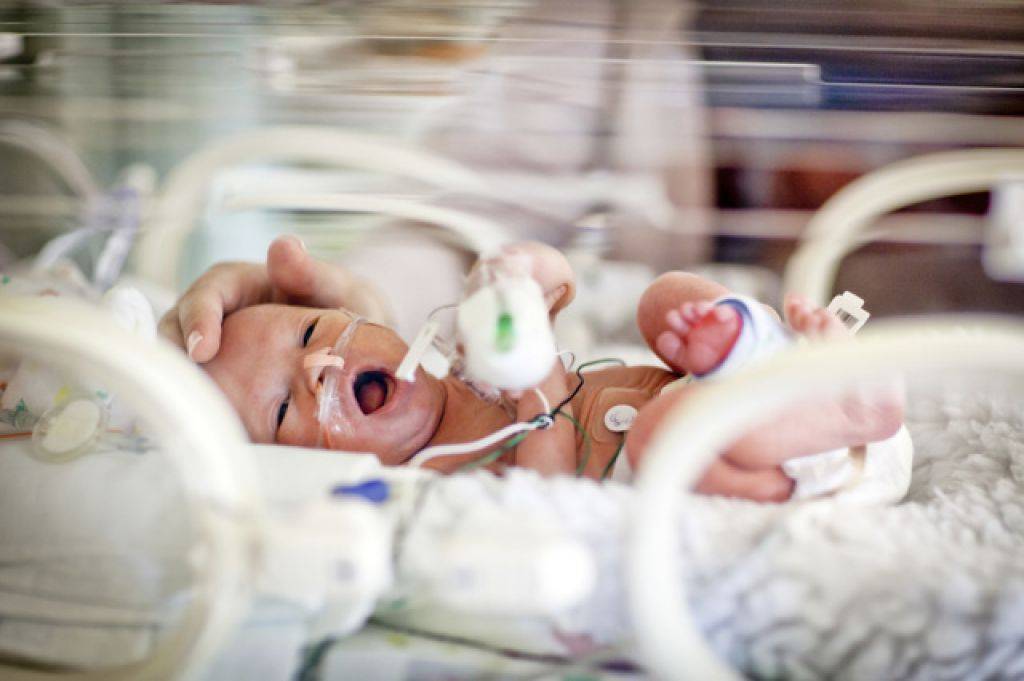 Врожденная или внутриутробная пневмония у новорожденных. каковы причины и последствия?