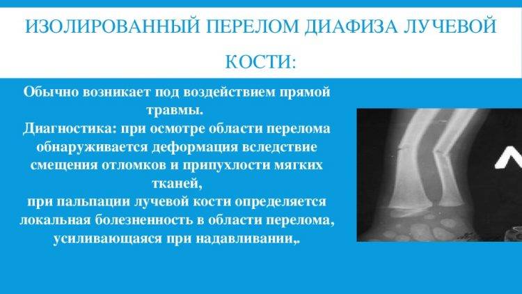 Профилактика переломов костей у детей