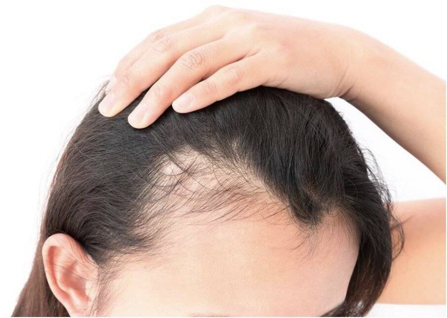 У ребенка выпадают волосы - что делать, почему это происходит, какое необходимо лечение?