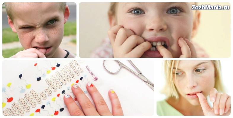 Как отучить ребенка грызть ногти в 3 года народные средства