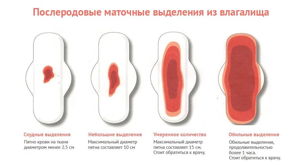 Менструальная чаша: ответы на популярные вопросы — медицинский женский центр в москве