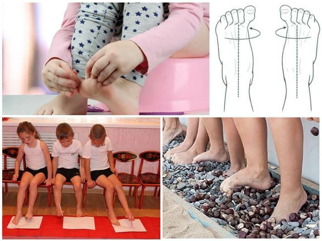 Упражнения при плоскостопии у детей 6-10 лет: подробно в картинках