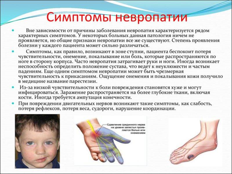 "неуклюжий ребенок" или синдром диспраксии у детей