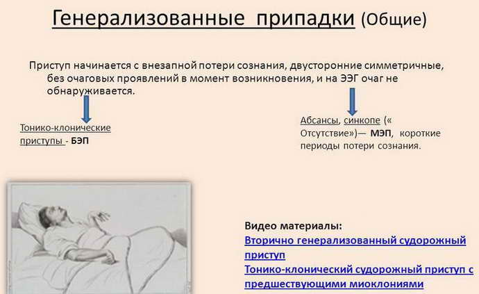 Детская эпилепсия излечима