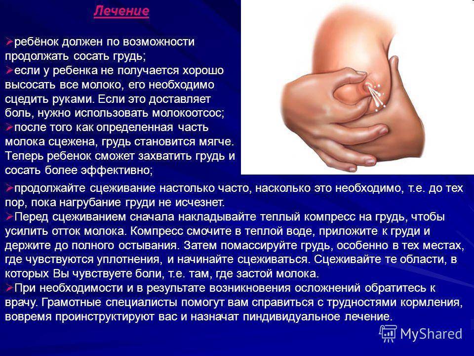 Заболевания молочных желез (мастит, мастопатия)