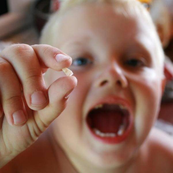 Как быстро вырвать молочный зуб у ребенка без боли самостоятельно в домашних условиях