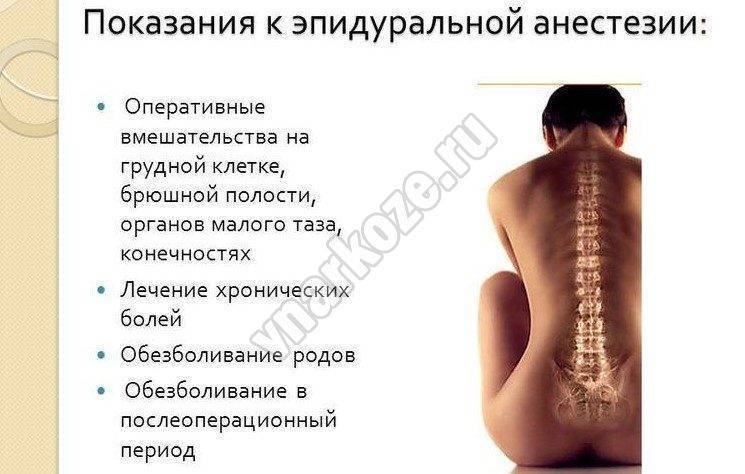 Болит спина после эпидуральной анестезии: что делать, лечение боли в пояснице, шее