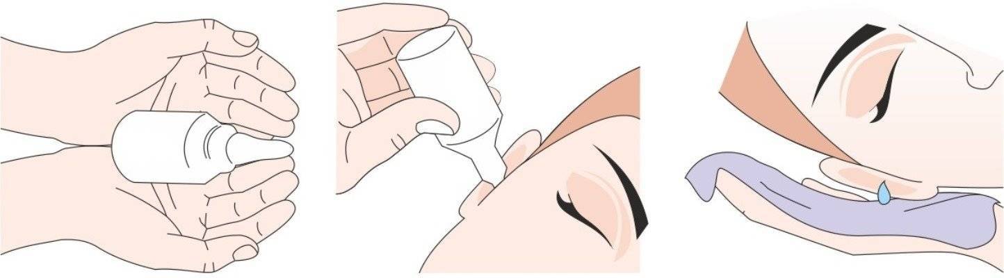 Как правильно закапывать капли в глаза ребенку? «ochkov.net»