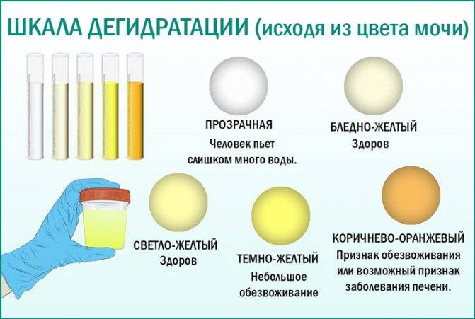 Цвет и прозрачность мочи: нормы и причины изменений