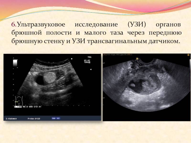 Узи брюшной полости презентация