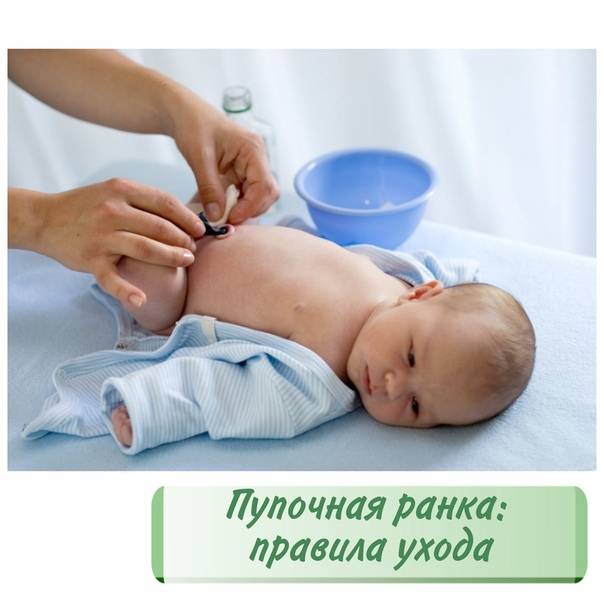 Инструкция по уходу и обработке пупка у младенца