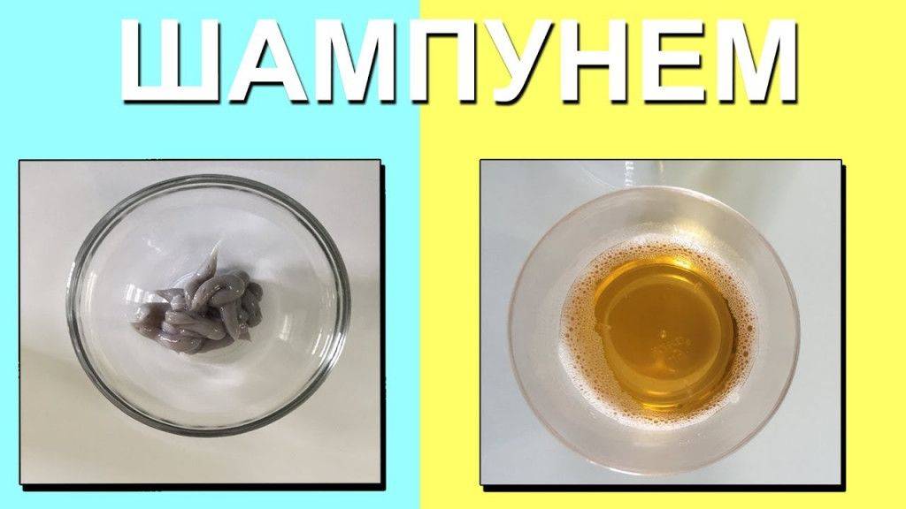 Определение пола ребенка