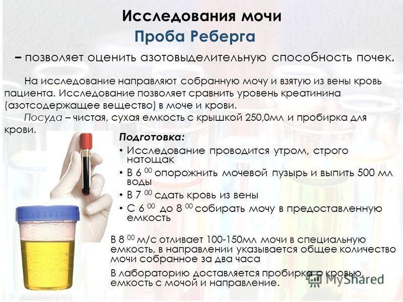 Как сдавать мочу с тампоном medistok.ru - жизнь без болезней и лекарств medistok.ru - жизнь без болезней и лекарств