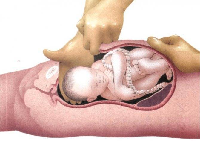 Когда можно жить половой жизнью после родов – рекомендации гинекологов, методы контрацепции