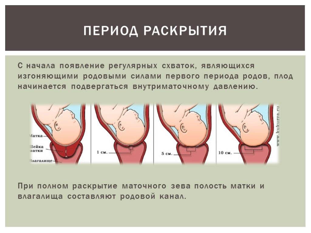 Схема схваток при родах