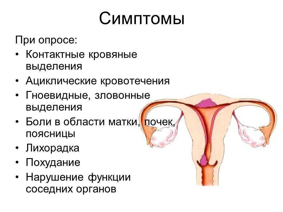 Возможные причины длительной менструации | москва