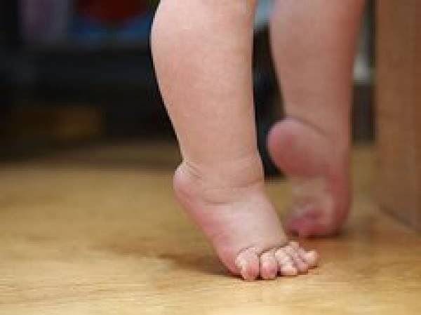 Ребенок ходит на носочках причины в 2 года