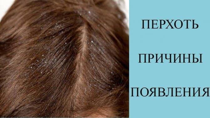Лечение волос и кожи головы