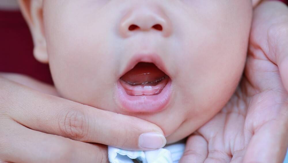 Насморк при прорезывании зубов у детей: как определить, что на зубы, сколько длится и чем лечить