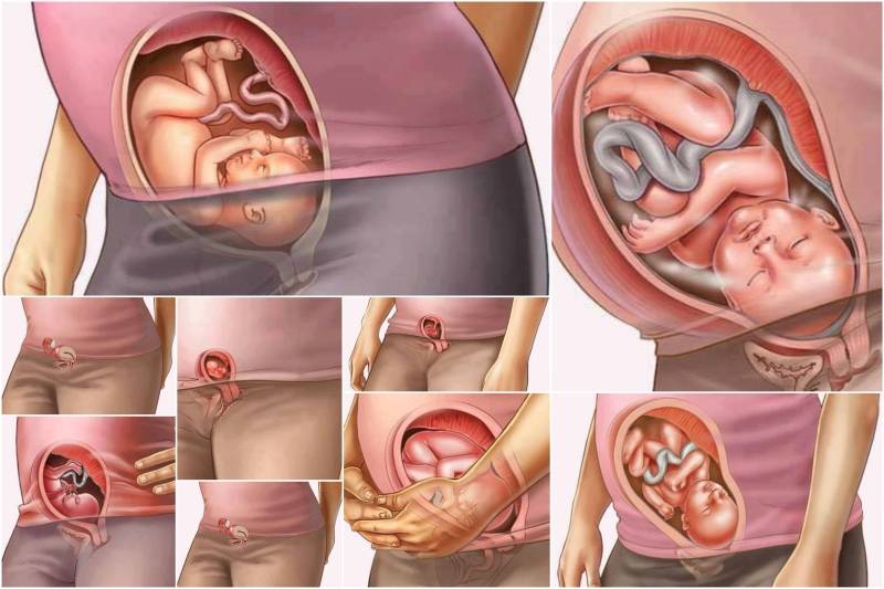32 неделя ощущения. Расположение плода при беременности на 8 месяце. Расположение ребенка в животе. Расположение ребенка в матке. Расположение малыша в животике.