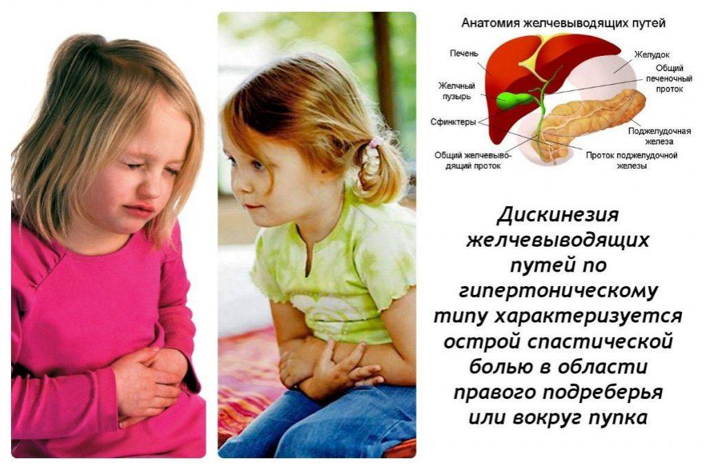 Дискинезия желчевыводящих путей | cимптомы и лечение у детей и взрослых