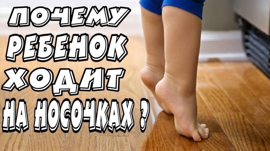 Почему ребенок ходит на носочках