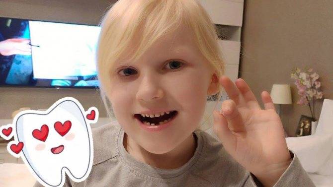 Как быстро вырвать молочный зуб у ребенка без боли самостоятельно в домашних условиях