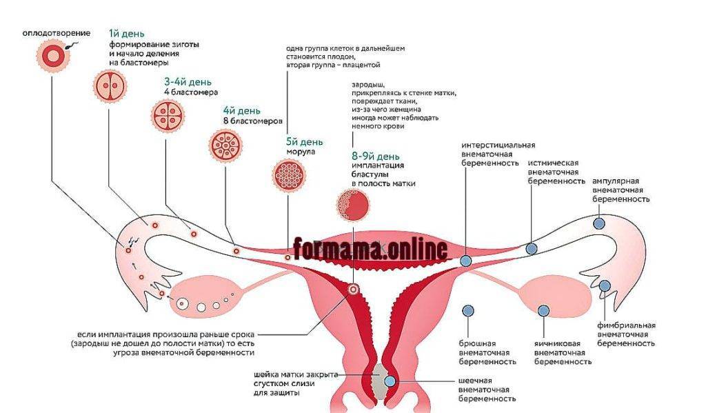 Эко при эндометриозе: какие шансы на беременность и можно ли делать - статья репродуктивного центра «за рождение»