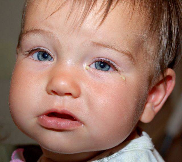 Конъюнктивит у месячного ребенка: чем лечить, как правильно проводить лечение в 1 и 2 месяца
