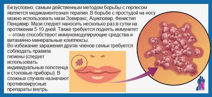 Гингивит у детей: симптомы. лечение гингивита. лечение гингивита в домашних условиях