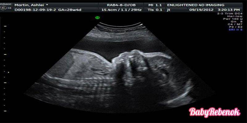 27 неделя беременности: признаки и ощущения женщины, симптомы, развитие плода
