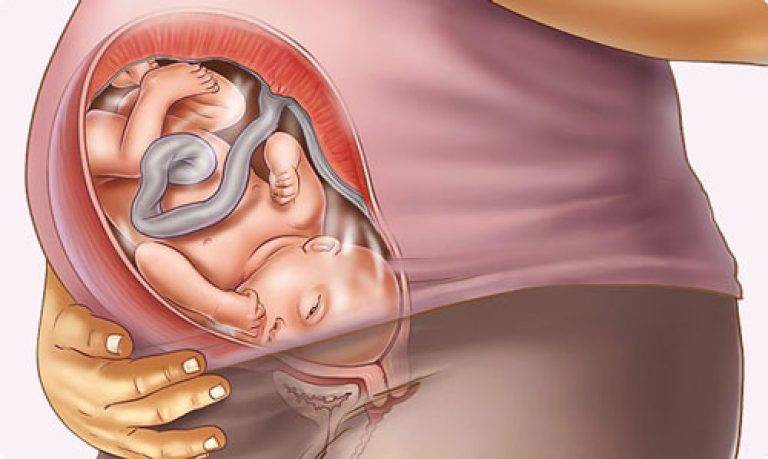 Шестая неделя беременности: признаки и ощущения, что происходит с малышом, что делать, если тянет живот и есть выделения, обследования хгч и узи