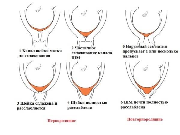 Как выглядит пробка, когда отходит у беременных: фото слизистой перед родами