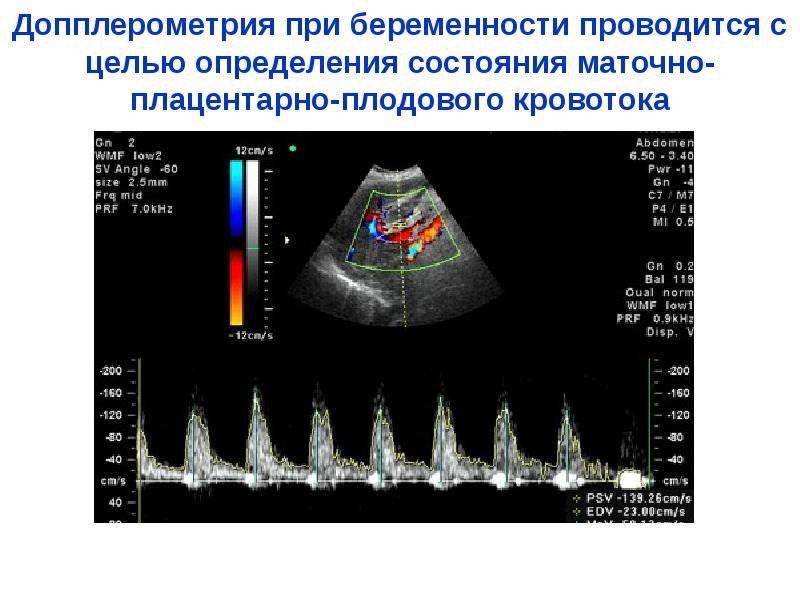 Ультразвуковая допплерография при беременности: показания и проведение уздг плода