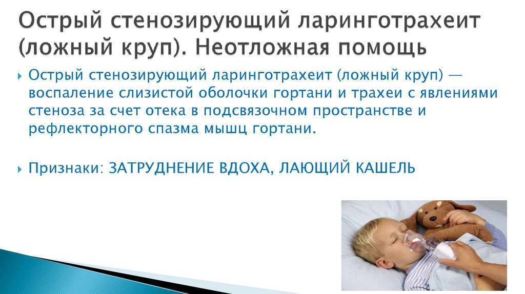 Ложный круп у детей: первая помощь и профилактика