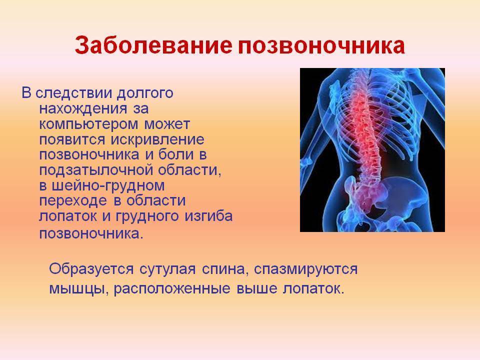 Симптомы остеохондроза поясничного отдела позвоночника, медикаментозное лечение при обостроении болезни