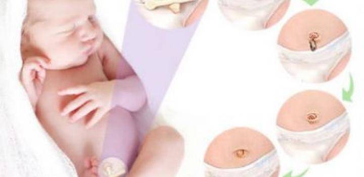 Хлорофиллипт для обработки пупка новорожденных: особенности применения и отзывы
