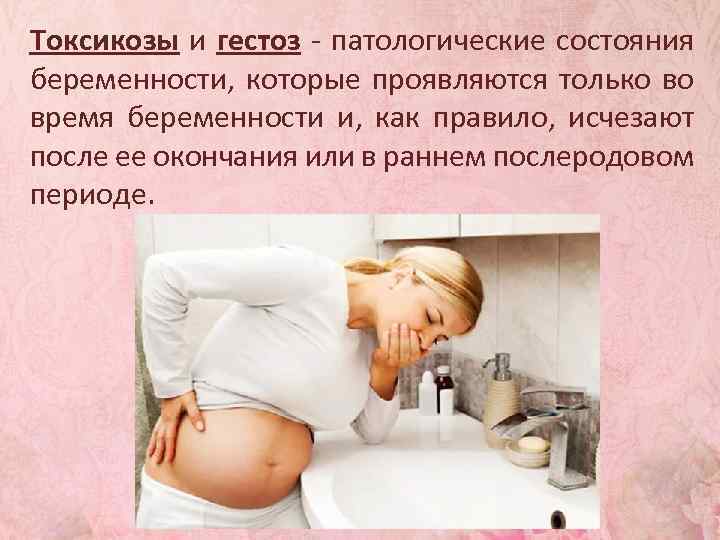 Тошнота и рвота у беременных