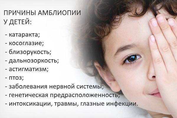 Синдром вялого ребенка. Амблиопия у детей. Амблиопия у детей причины. Амблиопия (синдром ленивого глаза). Ленивый глаз у детей причины.