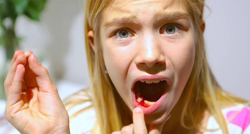 Как лечить кисту зуба дома: методы лечения и удаления