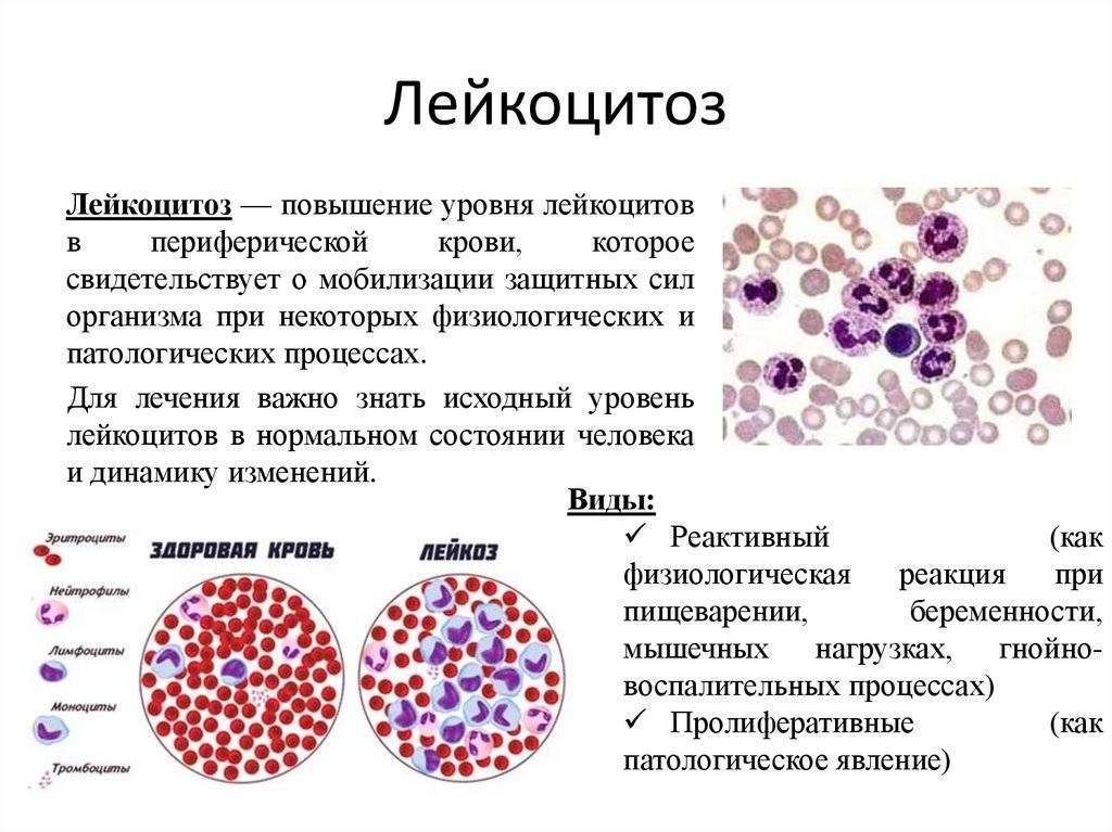 Анализ крови на лейкоциты