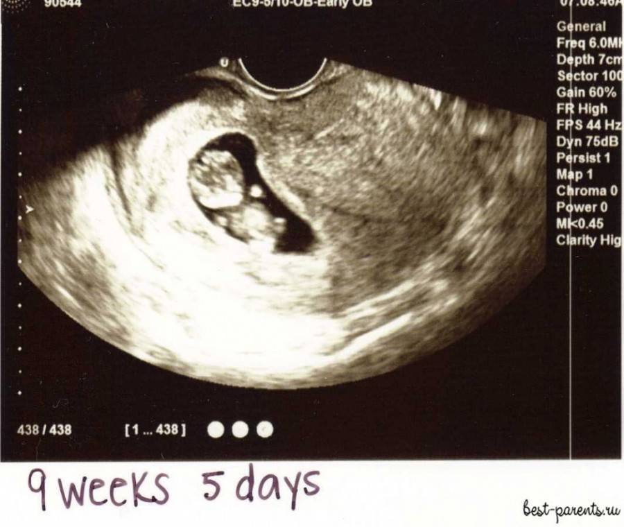 Третья неделя беременности
