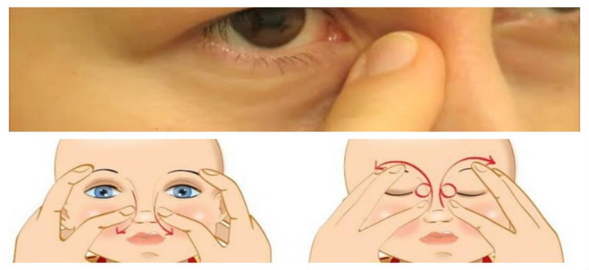 Как делать массаж глаз новорожденному при конъюнктивите? - энциклопедия ochkov.net