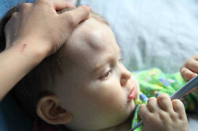 Первая помощь при ударе головой у ребенка – что делать, если ребенок упал и сильно ударился головой?