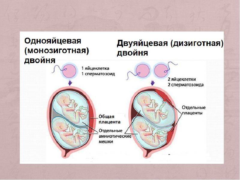Редукция эмбриона при многоплодной беременности | клиника "центр эко" в москве
