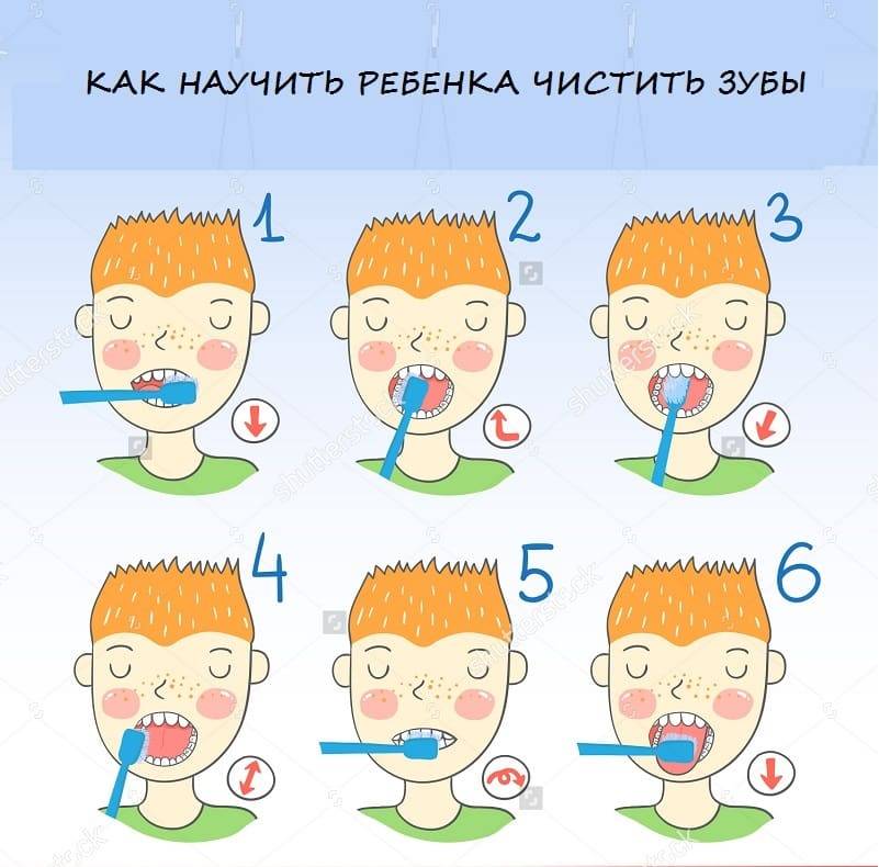 Кариес и пульпит молочных зубов: причины, симптомы, лечение - энциклопедия ochkov.net